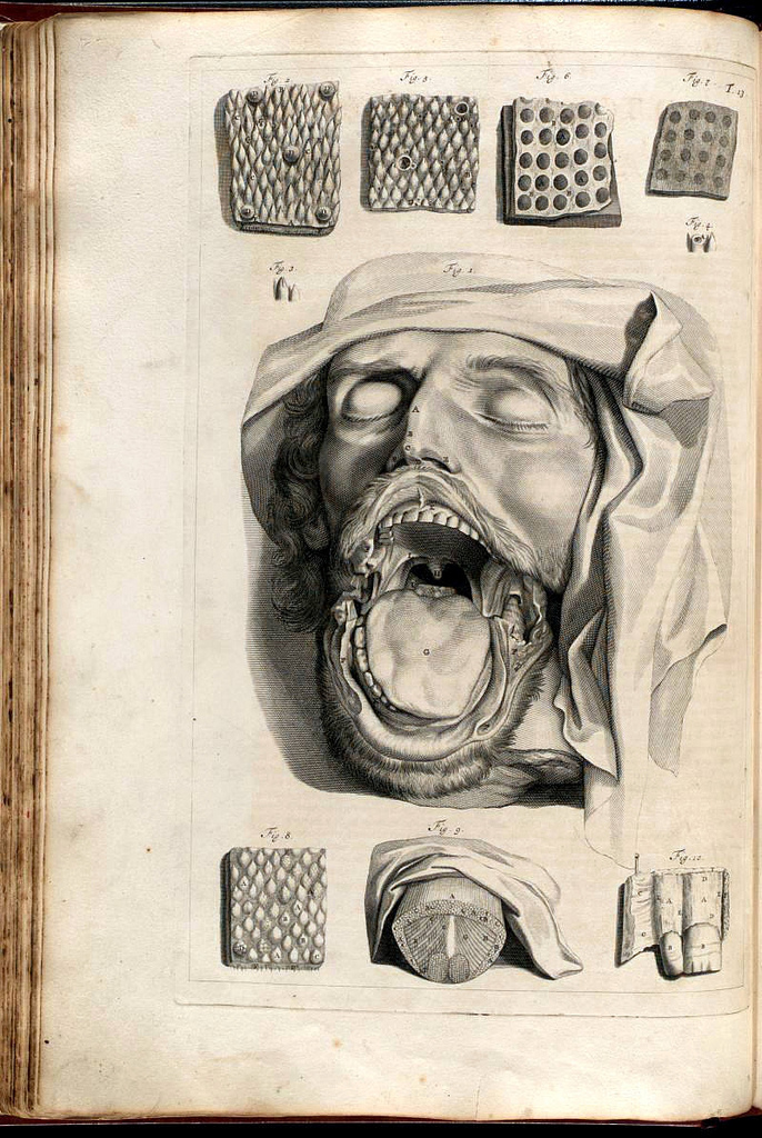 【閲覧注意】西洋の人体解剖図・その1（1500~1600年代）